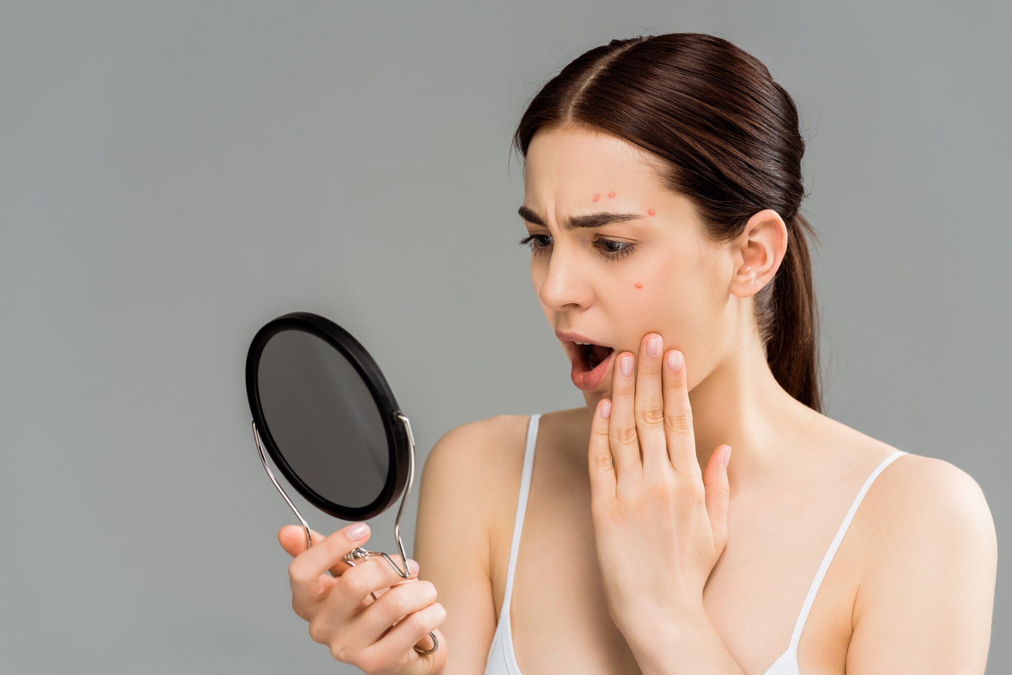 Can Collagen Cause Acne?